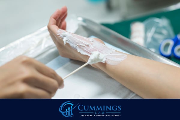 Long-Term Effects and Recovery Challenges