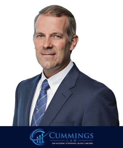 Nashville Burn Injury Lawyer